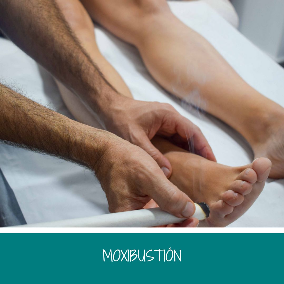 MOXIBUSTION EN SAKURA NOIA